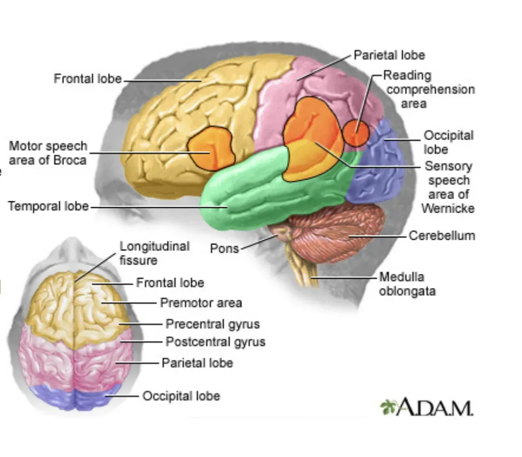 MRI